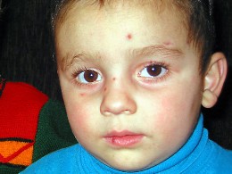 SOS-Kind in Georgien