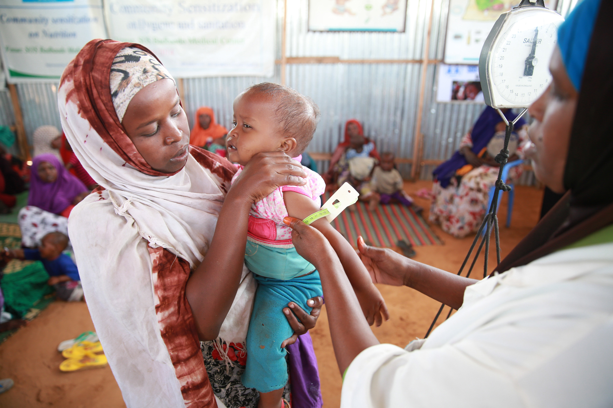Untersuchung eines Kindes in der SOS-Klinik Mogadischu
