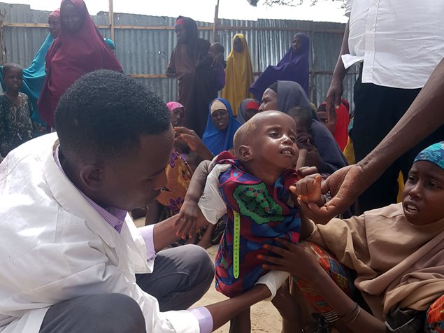 SOS-Mitarbeiter untersuchen mangelernährte Kinder bei Afgooye in Somalia. Foto: Abduljalil Abdillahi
